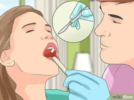 Image titled Get Rid of a Tooth Infection Step 3