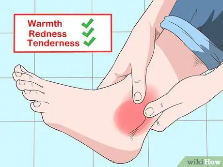 Image titled Identify Hyperuricemia Step 2