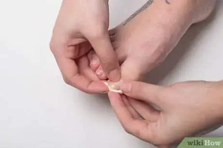 Image titled Soak an Ingrown Toenail Step 6