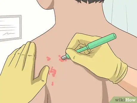 Image titled Treat Both Psoriatic Arthritis and Psoriasis Step 2