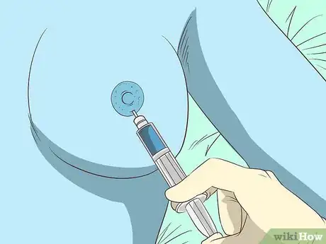 Image titled Treat Breast and Extramammary Paget's Disease Step 14