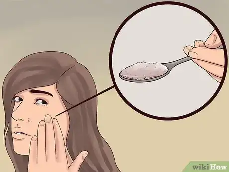 Image titled Treat Cystic Acne Step 17