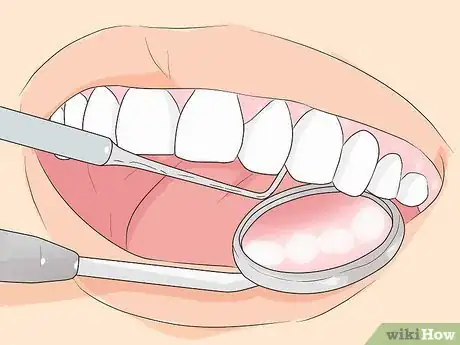 Image titled Prevent Tartar Step 12