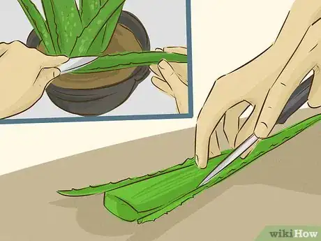 Image titled Use Aloe Vera to Treat Burns Step 5