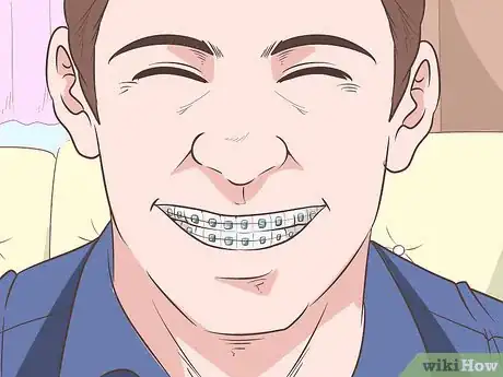 Image titled Look Good in Ceramic Braces Step 1