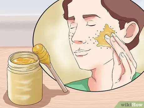 Image titled Get Rid of Pimple Redness Overnight Step 1