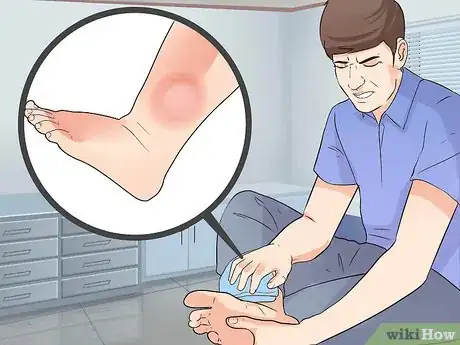 Image titled Recognize Symptoms of Heart Failure Exacerbation Step 4