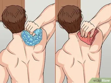 Image titled Relieve Chronic Pain Naturally Step 1