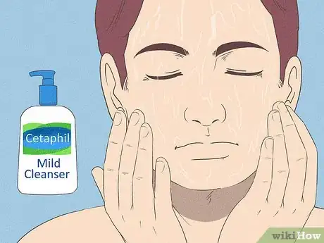 Image titled Get Rid of Acne if You Have Fair Skin Step 14