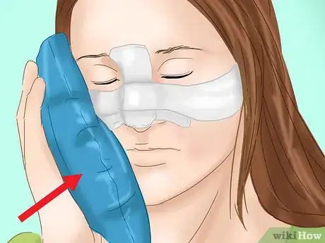 Image titled Prevent Bruising After Plastic Surgery Step 7