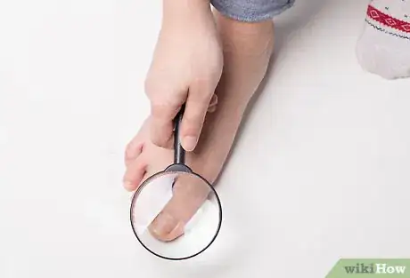 Image titled Soak an Ingrown Toenail Step 9