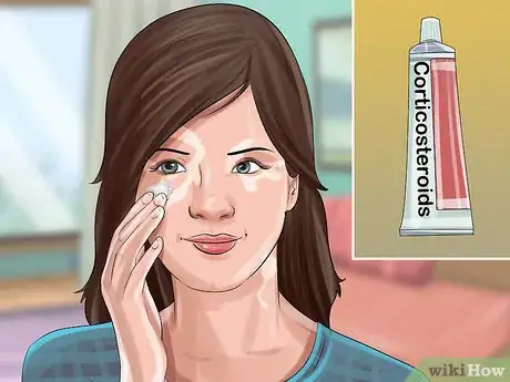 Image titled Diagnose Vitiligo Step 11