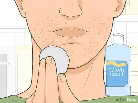 Image titled Get Rid of Razor Burn Fast Step 8