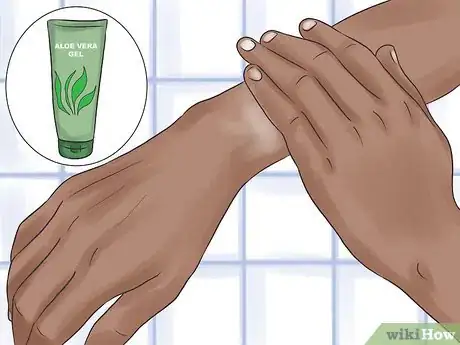 Image titled Care for Itchy and Irritated Skin Step 7