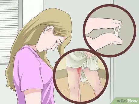 Image titled Reduce Your Gynecologic Cancer Risk Step 7