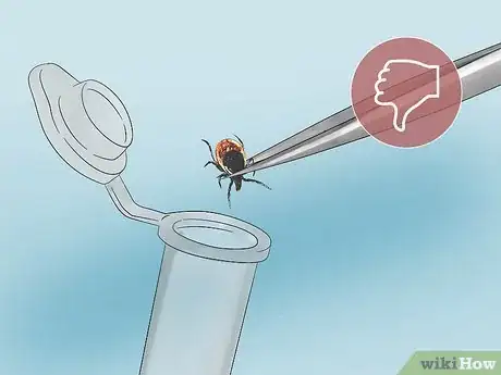 Image titled Get a Tick Head Out Step 9