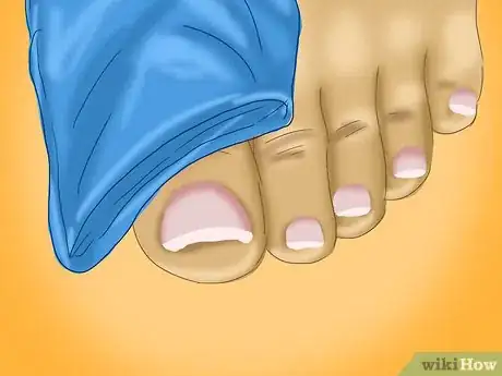 Image titled Relieve a Sore Damaged Toe Step 2