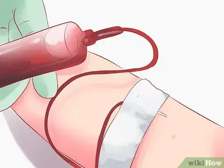 Image titled Determine Your Blood Type Step 3