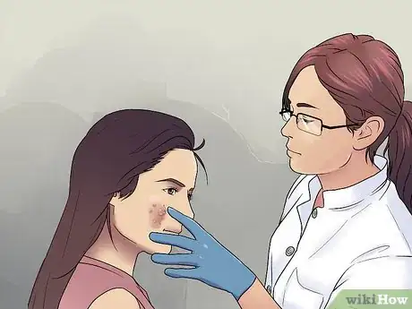Image titled Get Rid of Cystic Acne Scars Step 7