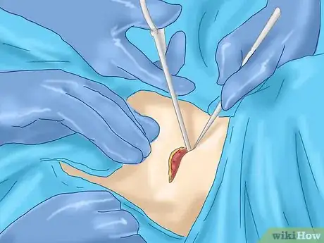 Image titled Prevent Thyroid Cancer Step 6