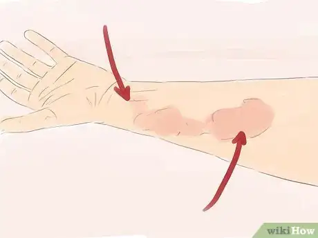 Image titled Tell if Someone Is Abusing Prescription Drugs Step 4