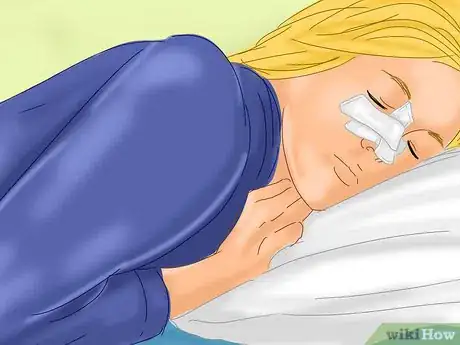 Image titled Prevent Bruising After Plastic Surgery Step 9