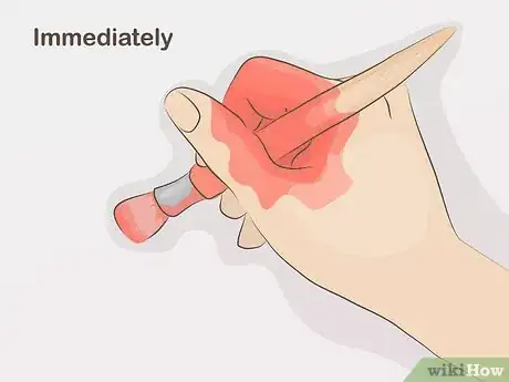 Image titled Remove Acrylic Paint from Skin Step 1