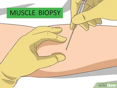Image titled Diagnose Muscular Dystrophy Step 11