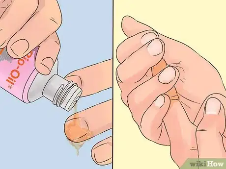 Image titled Use Bio Oil Step 10