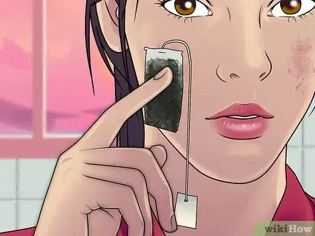 Image titled Get Rid of Cystic Acne Scars Step 5