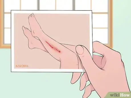 Image titled Sue a Homeowner for Injuries As a Trespasser Step 3