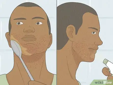 Image titled Get Rid of Razor Burn Fast Step 3