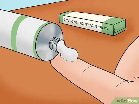 Image titled Get Rid of Peeling Skin Step 8