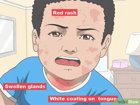 Image titled Diagnose Rheumatic Fever Step 5