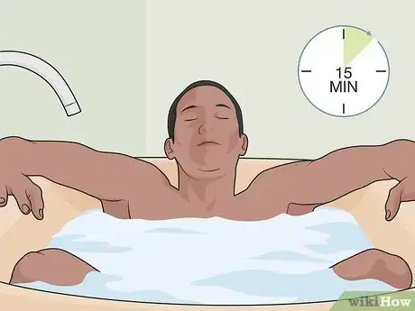 Image titled Control Psoriasis Step 09