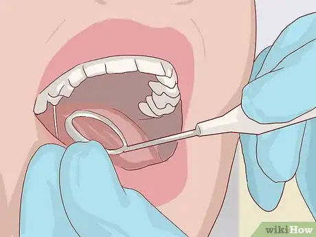 Image titled Treat Weak Tooth Enamel Step 5