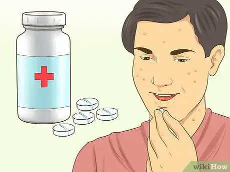 Image titled Know if You Need a Prescription Acne Treatment Step 10