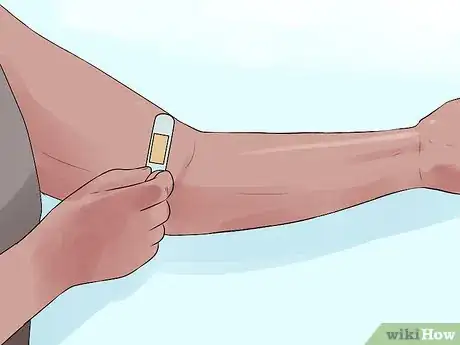 Image titled Recover from an Angioplasty Step 9