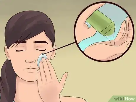 Image titled Treat Cystic Acne Step 16