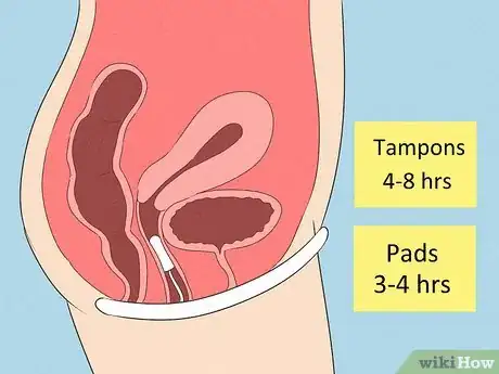 Image titled Prevent Yeast Infections Naturally Step 5