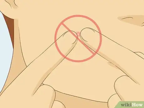Image titled Treat Adult Acne Step 23