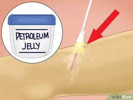 Image titled Heal a Cut Due to Dry Skin Step 2