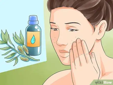 Image titled Use Household Pantry and Bathroom Items to Remove Acne Step 3