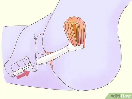 Image titled Use Spermicides Step 3