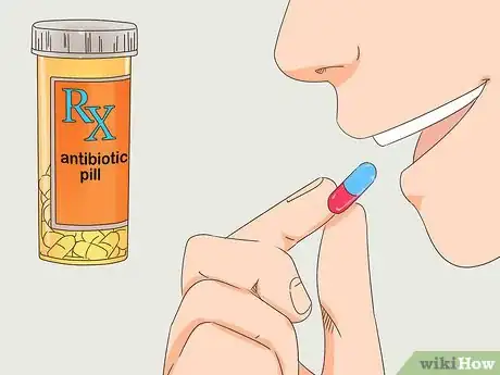 Image titled Treat an Infected Ear Piercing Step 4