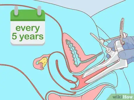 Image titled Test for HPV Step 9