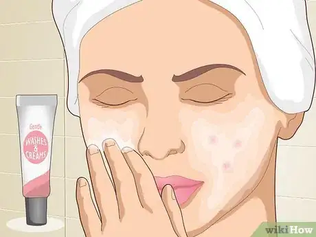 Image titled Reduce Scars Naturally Step 12