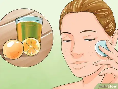 Image titled Use Household Pantry and Bathroom Items to Remove Acne Step 7