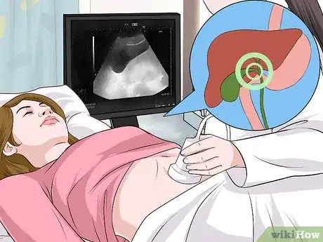 Image titled Diagnose Viral Hepatitis Step 8