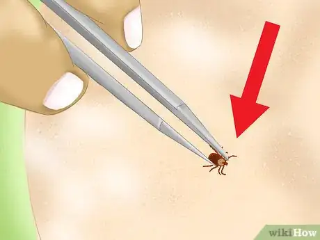 Image titled Prevent Tick Bites While Camping Step 23